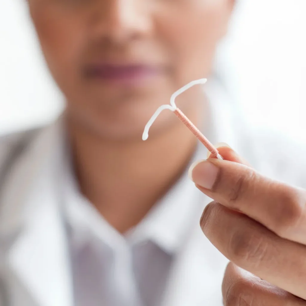 A healthcare provider holds a copper intrauterine device (IUD).