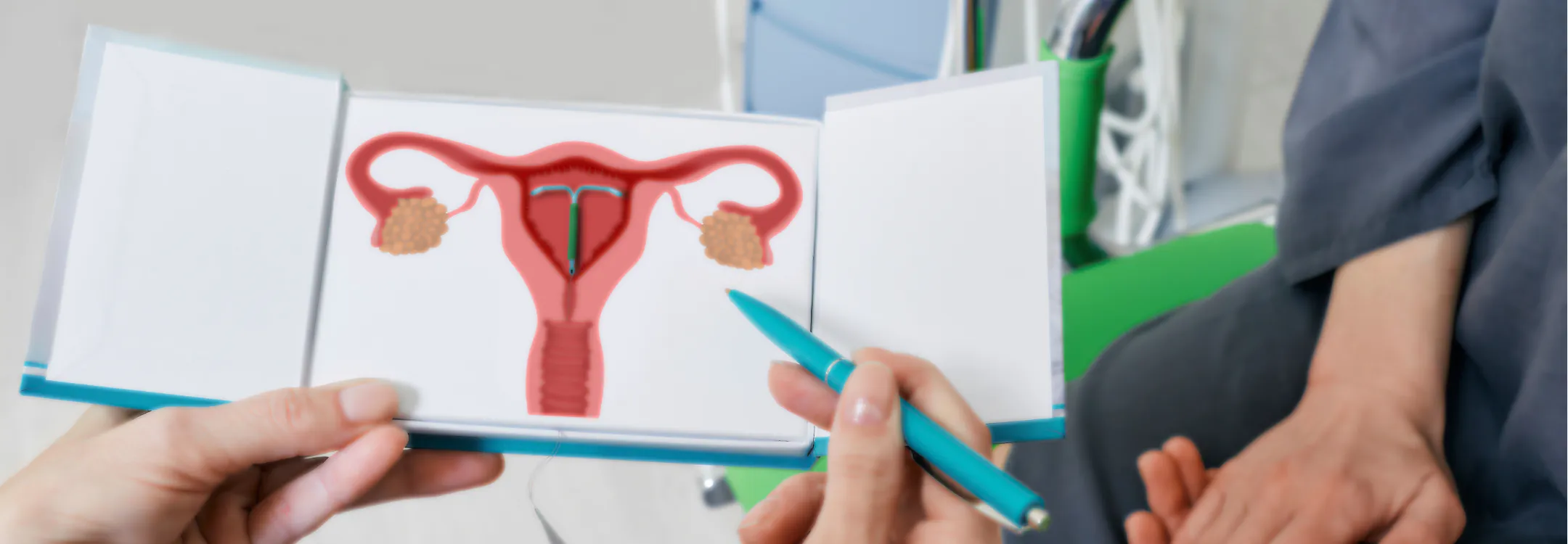 A doctor points to an anatomical diagram of a uterus with an IUD during a patient consultation.