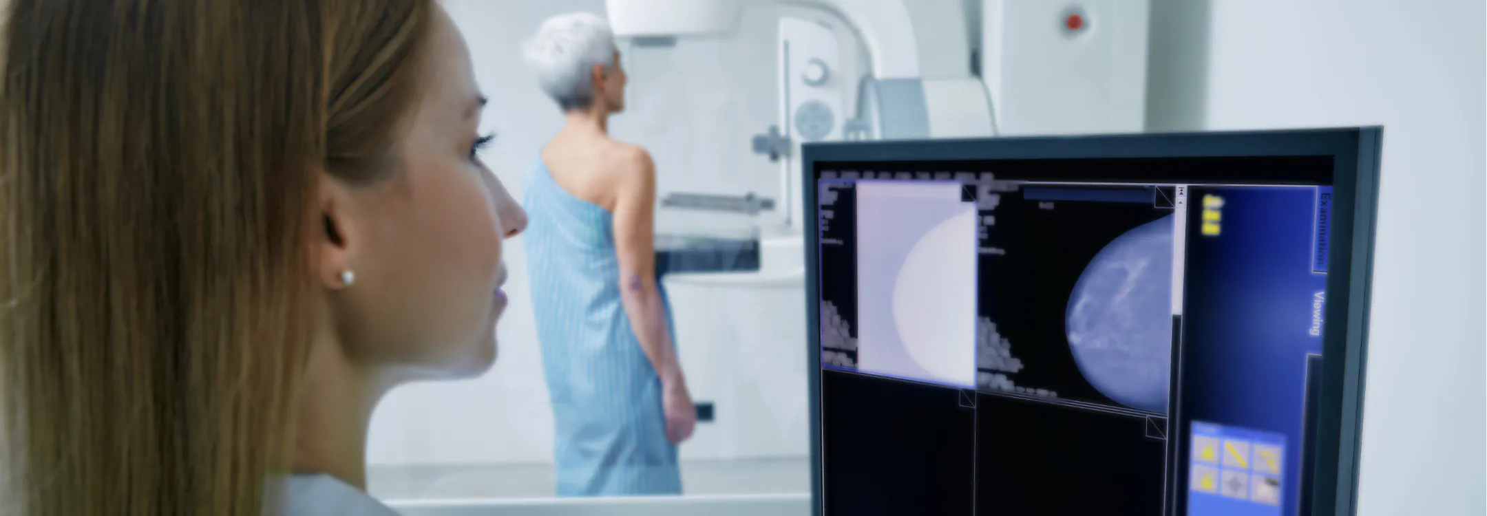 A technologist reviews mammogram scans on a monitor during a patient's breast cancer screening.