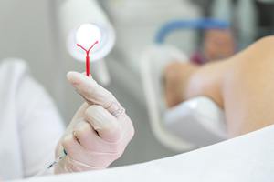 Gynecologist holding an IUD birth control device