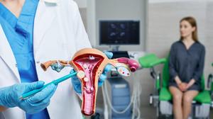 doctor pointing at a model of fibroids.